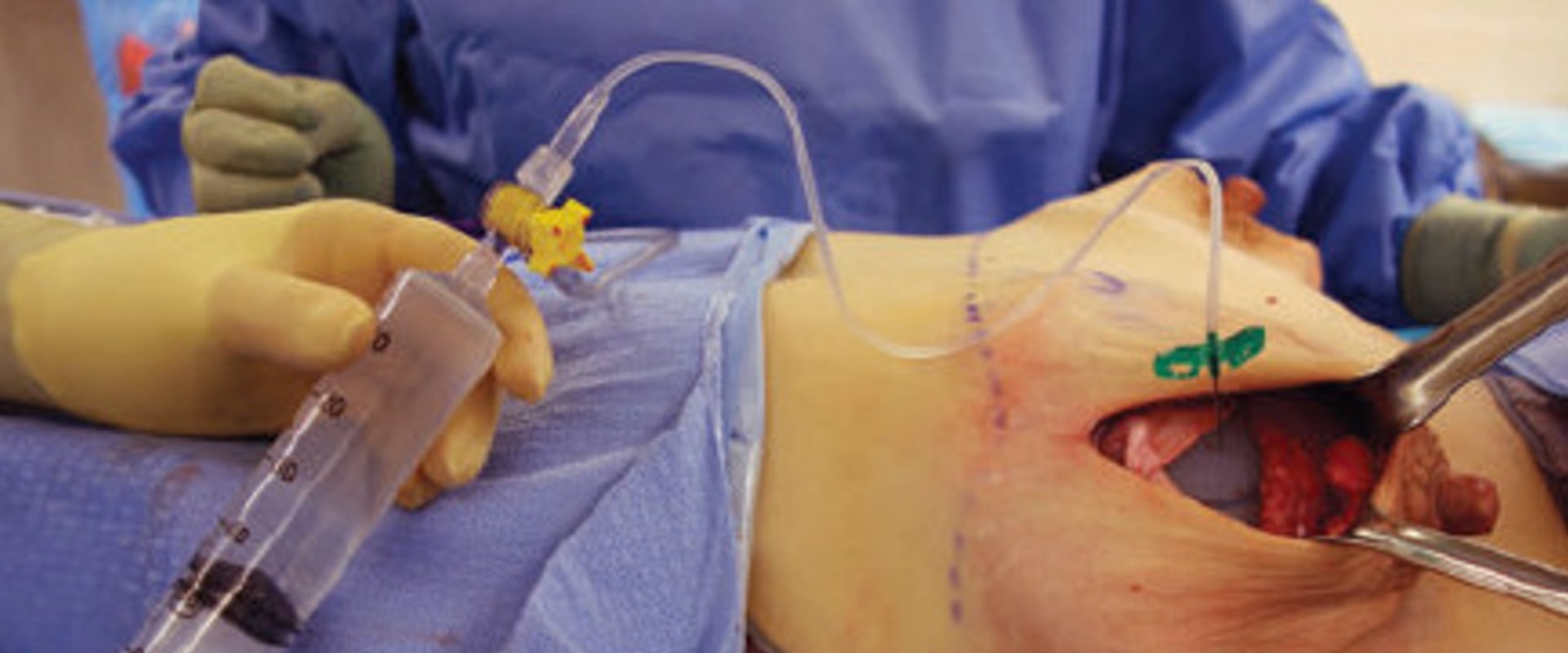 Why are surgeons called plastic surgeons?