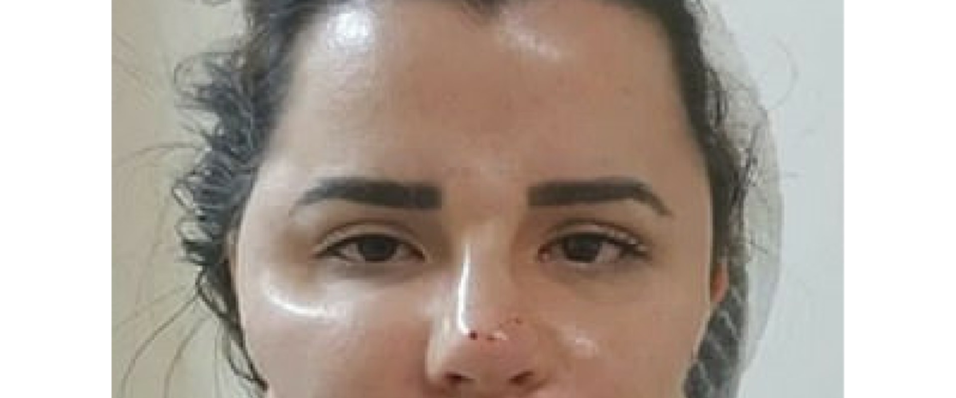 Can plastic surgeons make millions?
