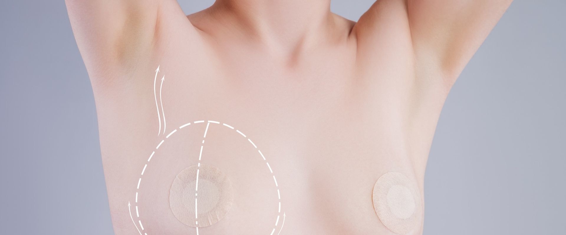 Nipple Reconstruction: Restoring Confidence and Femininity