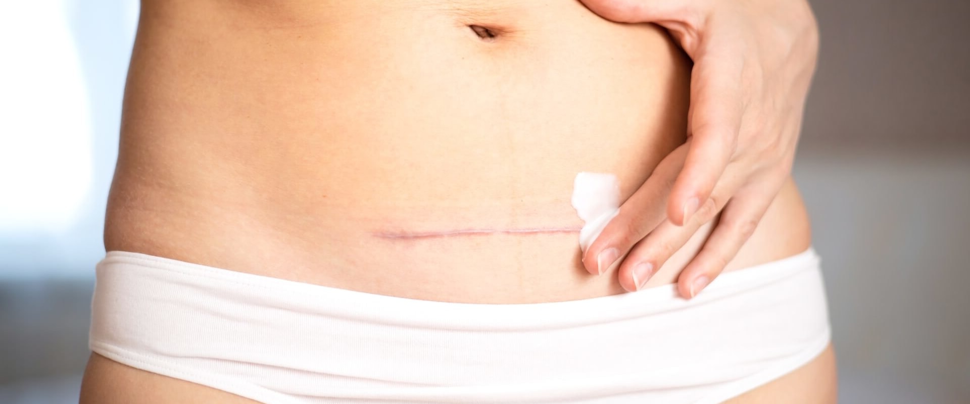 A Comprehensive Look at Scar Revision Surgery