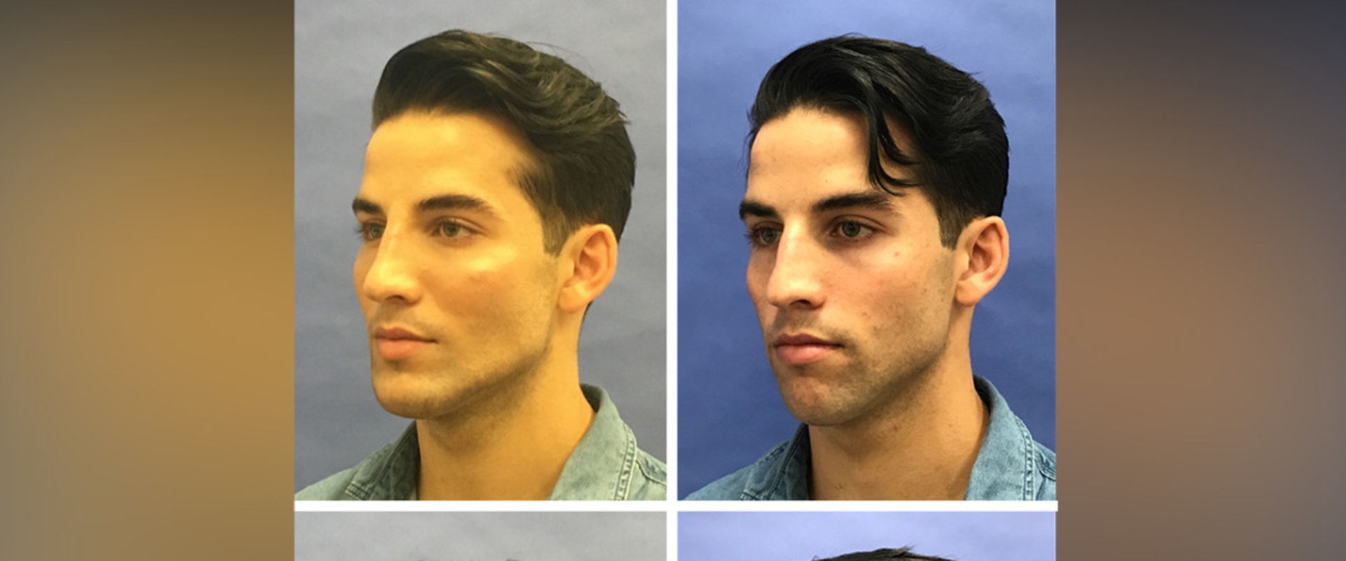 What's the most a plastic surgeon can make?