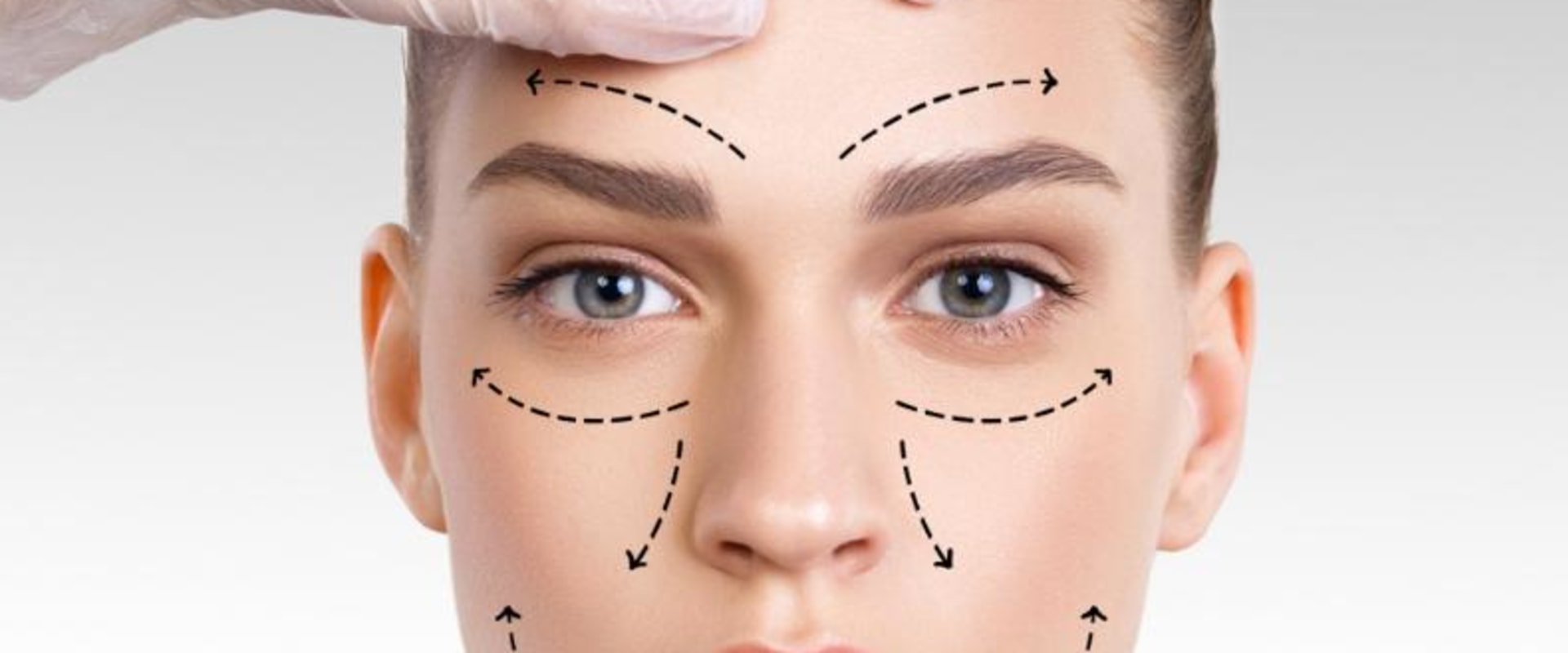 A Comprehensive Guide to Facelifts: What You Need to Know