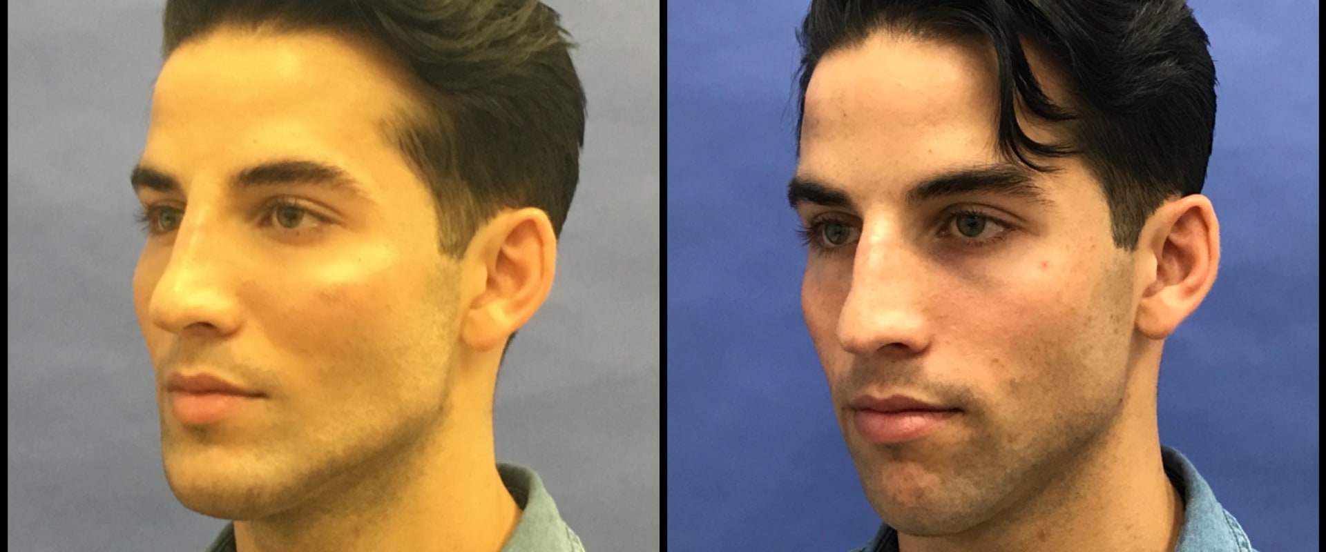 Why are plastic surgeons paid so much?