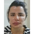 Can plastic surgeons make millions?