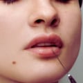 Understanding Fillers for Plastic Surgery Procedures
