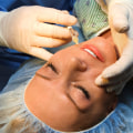 Can you negotiate prices with a plastic surgeon?