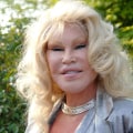 Which plastic surgeon makes the most money?