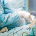 Flap Reconstruction: Understanding the Procedure and Finding the Right Plastic Surgeon