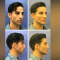 What's the most a plastic surgeon can make?