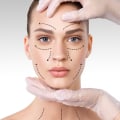 A Comprehensive Guide to Facelifts: What You Need to Know