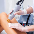 The Benefits and Process of Laser Hair Removal