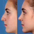 What does plastic mean in plastic surgeon?