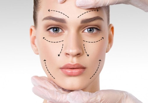The Ultimate Guide to Facelifts