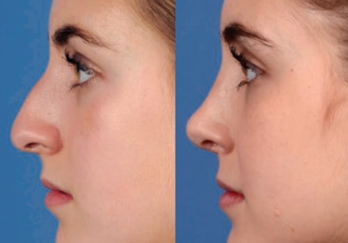 What is the alternative name for a plastic surgeon?