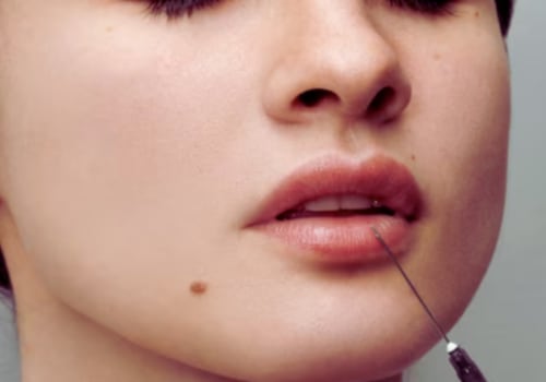 Understanding Fillers for Plastic Surgery Procedures