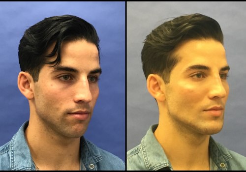 Why are plastic surgeons paid so much?