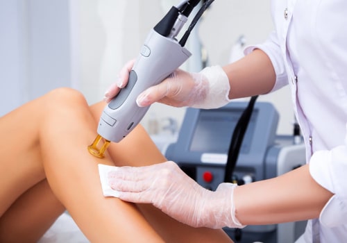 The Benefits and Process of Laser Hair Removal